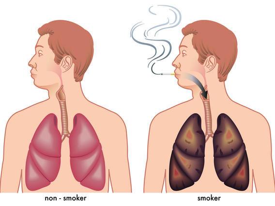 完不成以下4個測試，說明肺部出現問題，你該戒菸了