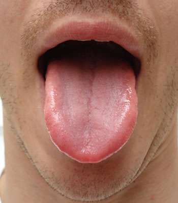 從「舌頭紋路」看出你的健康狀況！出現「這9種狀況」請馬上到醫院掛號！
