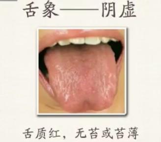 珍貴的舌診圖譜，通過舌頭認識自己的身體狀況
