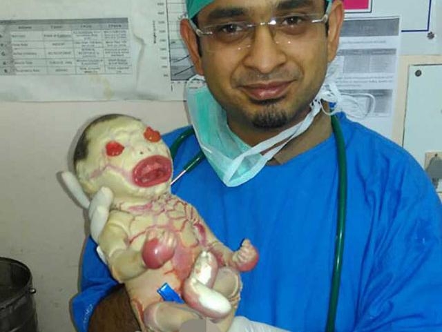 這名小女嬰一生下來就嚇哭了護士，醫生也無奈搖頭，沒想到3天後卻說：「這是上天最大的禮物！」
