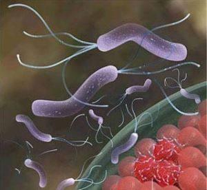 幽門螺桿菌最怕的4種食物，每天堅持吃，腸胃不難受