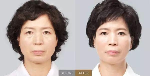女人顯不顯老，關鍵還得看眼角!可以達到除皺的效果。