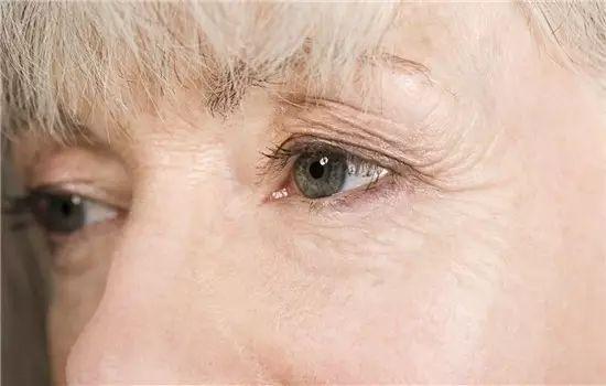 女人顯不顯老，關鍵還得看眼角!可以達到除皺的效果。