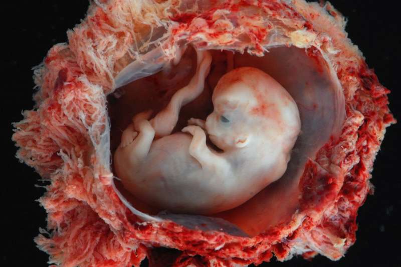 8周人流后的胎儿图片图片