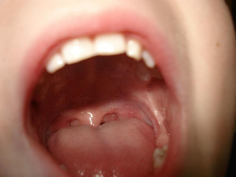 看舌頭診斷疾病注意自己的舌頭能夠了解身體壯況！