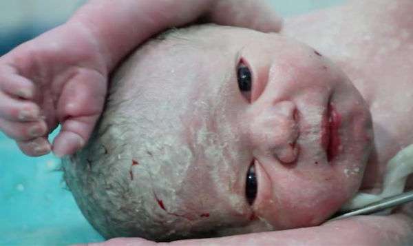 敘利亞媽媽臨盆時被空襲！　重傷生下「全身蒼白」無心跳嬰兒　醫生神救援讓他發出哭聲