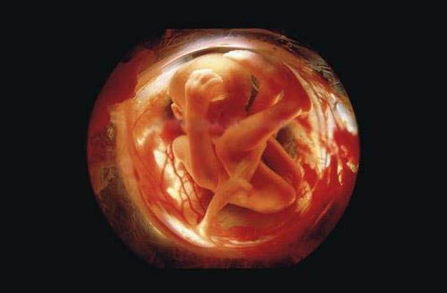 96天胎儿高清图片图片