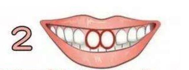 心理測試：你的牙齒是哪一種形狀？測你有沒有天生的富貴命！