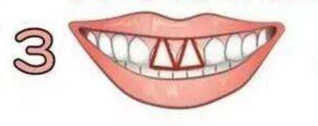 心理測試：你的牙齒是哪一種形狀？測你有沒有天生的富貴命！