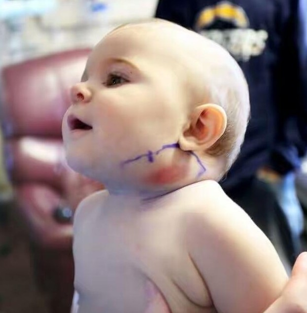 父母帶脖子無故長出一根東西的寶寶去檢查，結果連醫生都看到傻眼