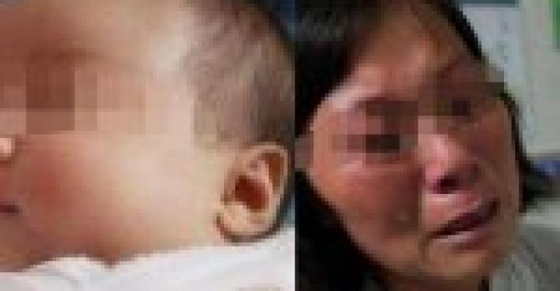 女子連生2胎孩子都沒有眼睛，醫生一檢查，怒駡全家「禽獸不如」