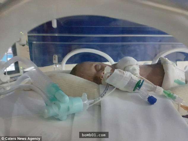 這位媽媽「在死後123天」成功生下雙胞胎，醫生都驚訝「這是前所未見的奇蹟」！