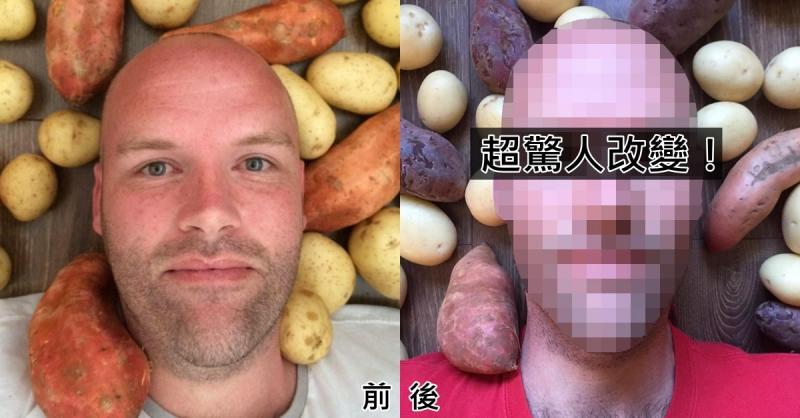 只吃馬鈴薯整整一年會膩嗎？這男人直接掉了三分之一的體重…卻內含某種隱憂！