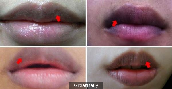 護唇膏拚命塗嘴唇還是黑?!你知道為什麼你的嘴唇這麼黑嗎?? 60%都是你自己造成的!!