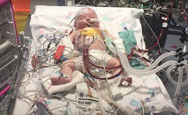 母愛創奇蹟 寶寶心跳停15小時 數度瀕死終生還 | 先天性心臟漏洞 | 大難不死 | 男嬰