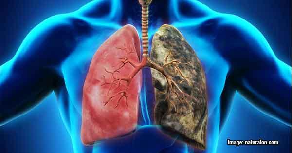 吸煙者注意：這裏有教你如何在3天內凈化肺部的好方法哦！