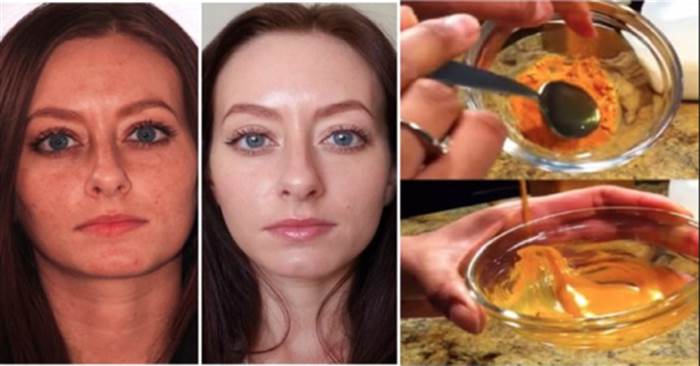 人未老，斑先到？在家自製簡易麵膜，殲滅糾纏多年的「黑斑」兼抗老！敷出逆齡神話