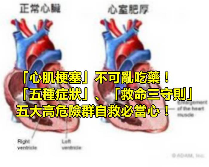 「心肌梗塞」不可亂吃藥！「五種癥狀」、「救命三守則」五大高危險群自救必當心！