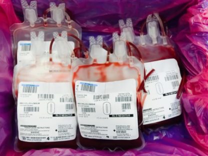 O型血的人有好消息！以後A和B型血都可以捐給O型血的人，再也不怕血庫的血不夠用了！