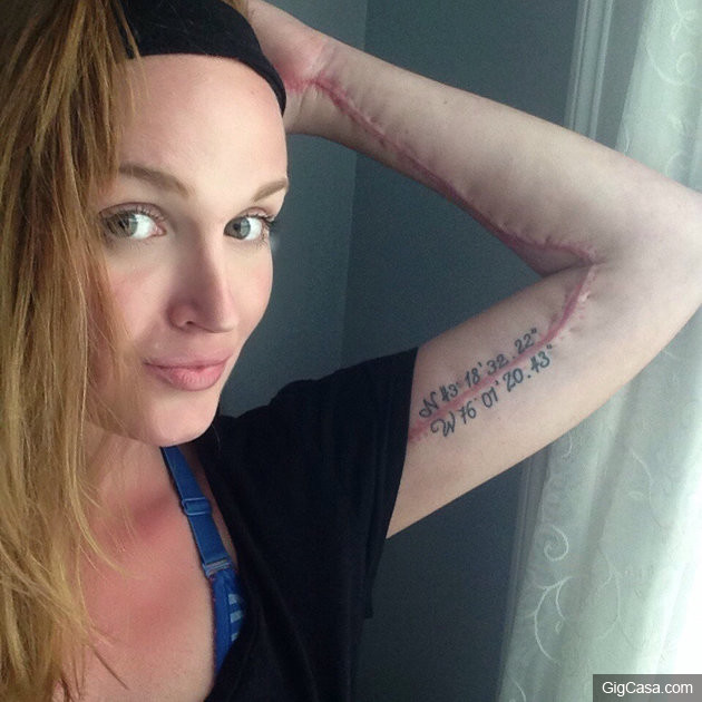 Erin Rhoades - her arm with tattoo now (Collect/PA Real Life)