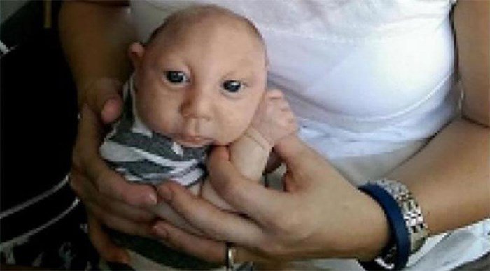 這名患有「平腦症」小男嬰醫生都說沒救了，但他長大後的模樣真的是我看過最可愛的寶寶！
