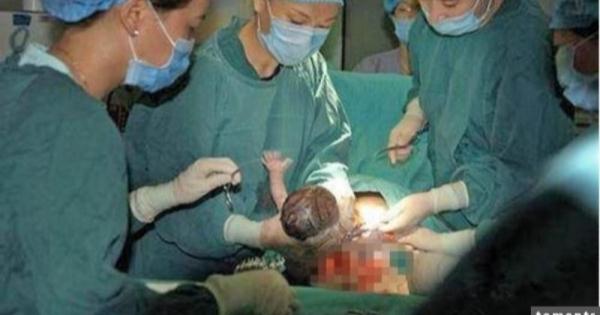剖腹後她問寶寶是男是女，醫生看完後驚訝到說不出話....這個到底是誰...？原來都是產婦做了這件事！