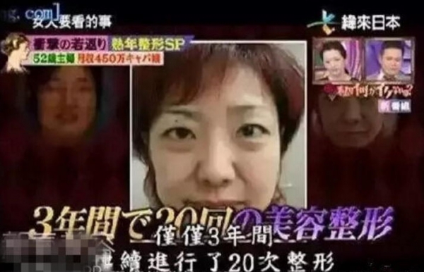 為了養家賺錢，她三年內動刀20次從「52歲」整成「25歲」！所有人看到她現在的樣子都跪了...