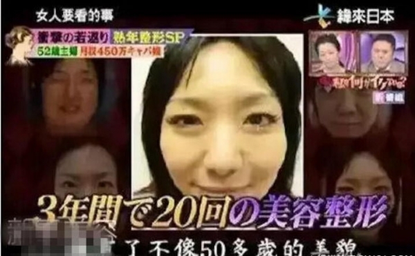 為了養家賺錢，她三年內動刀20次從「52歲」整成「25歲」！所有人看到她現在的樣子都跪了...