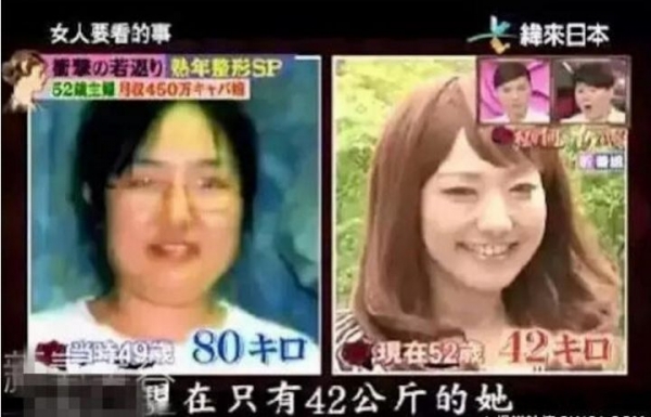 為了養家賺錢，她三年內動刀20次從「52歲」整成「25歲」！所有人看到她現在的樣子都跪了...