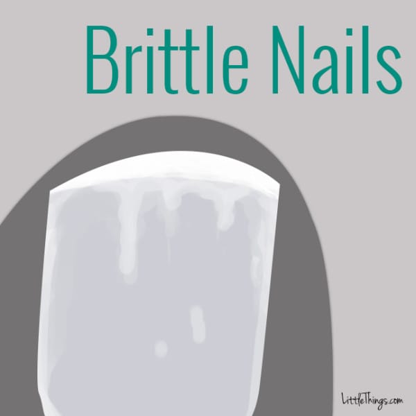 brittlenails