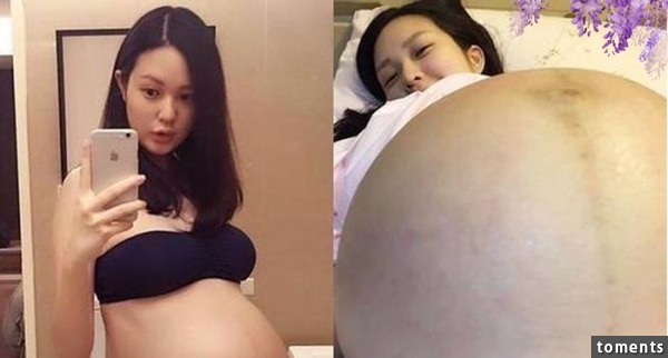 年輕女孩才懷孕四個月，肚子卻腫得有十個多月巨大！真相連醫生都嚇傻了！