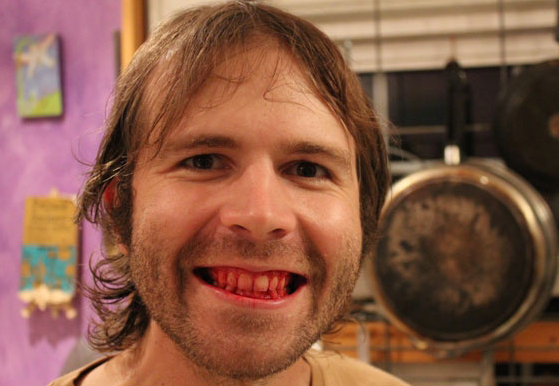 UNILADs This Man Has Eaten Nothing But Raw Meat For Past Seven Years image