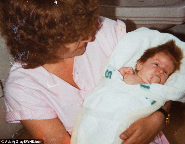 Mrs Dinsdale, pictured with her mother Patsy Dixon, was born with every bone in her body broken, and over the years has suffered hundreds of fractures - some being triggered by an act as simple as a sneeze