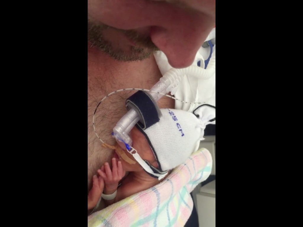 這對「不到1公斤的7個月早產雙胞胎」因為接下來的不可思議舉動已經讓很多網友忍不住爆哭了！