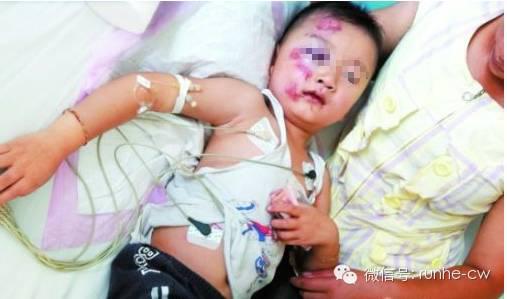 4歲男童從3樓摔下所有人都心疼,媽媽卻喊”住手“不要扶