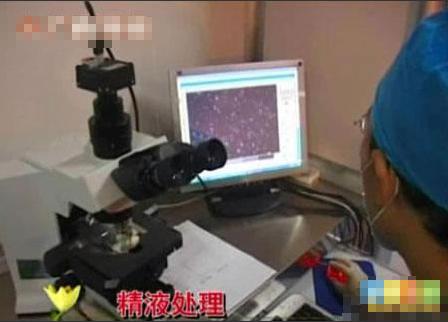 超囧丈夫將自己妻子人工受精完整的全過程曝光，媽媽不易！