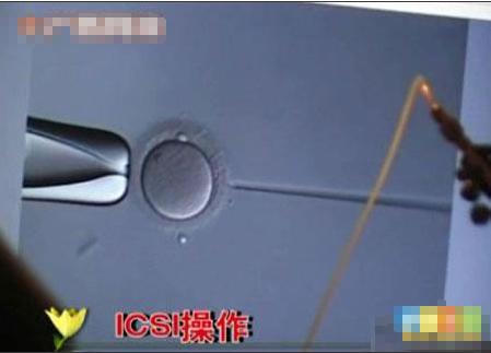 超囧丈夫將自己妻子人工受精完整的全過程曝光，媽媽不易！