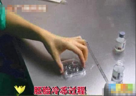 超囧丈夫將自己妻子人工受精完整的全過程曝光，媽媽不易！