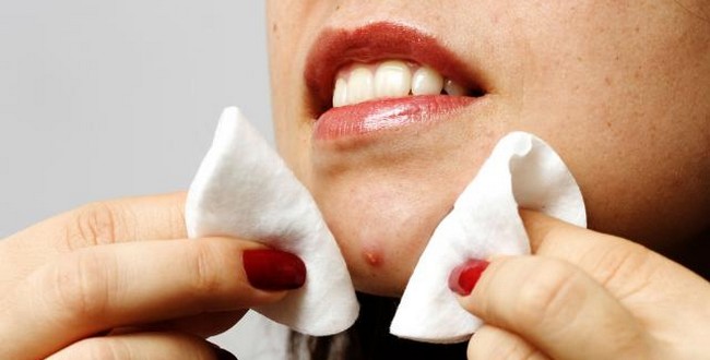 大多數人擠痘痘都擠錯了而且還錯失享受100%快感的機會。專家說一定要遵守這10個重要步驟！