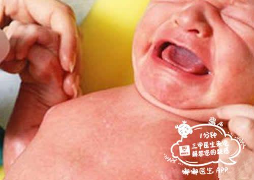 半月大寶寶竟得乳腺炎，只因被奶奶擠乳 頭