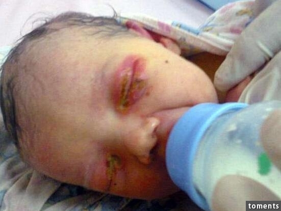 女嬰一出生眼睛就成了這樣子,不停地流膿!狠心的奶奶竟把她丟掉,任動物們分食...但後來所發生的一切,讓大家都震驚了!阿彌