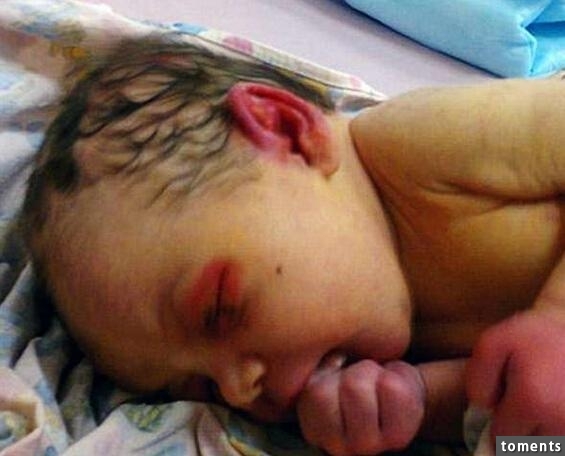 女嬰一出生眼睛就成了這樣子,不停地流膿!狠心的奶奶竟把她丟掉,任動物們分食...但後來所發生的一切,讓大家都震驚了!阿彌