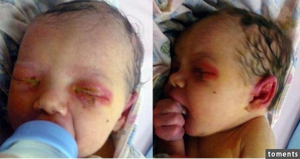 女嬰一出生眼睛就成了這樣子,不停地流膿!狠心的奶奶竟把她丟掉,任動物們分食...但後來所發生的一切,讓大家都震驚了!阿彌