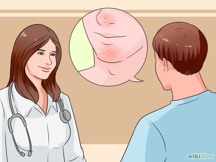 以Prevent Blackheads Step 13為標題的圖片
