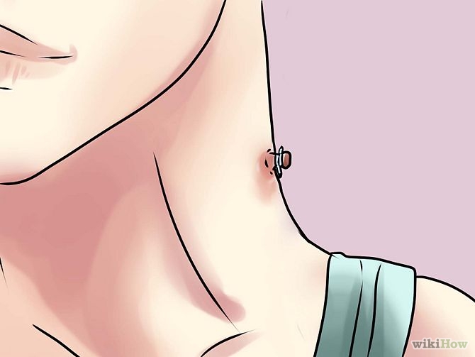 Remove a Skin Tag from Your Neck Step 11.jpg