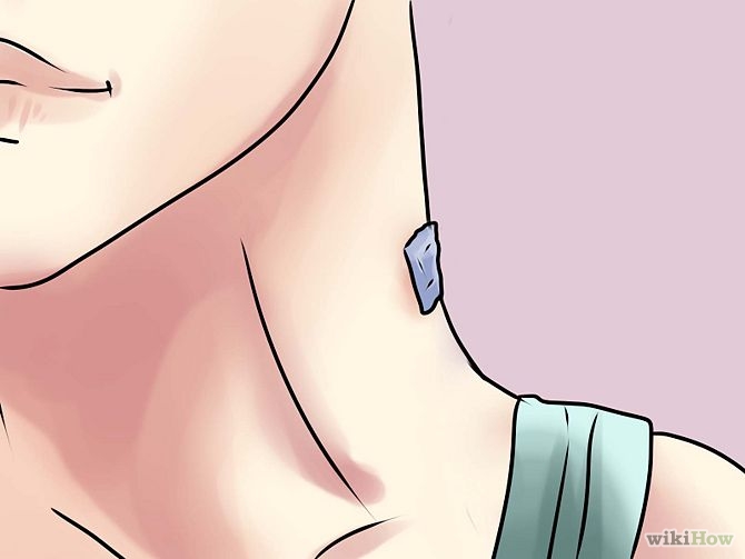 Remove a Skin Tag from Your Neck Step 12.jpg