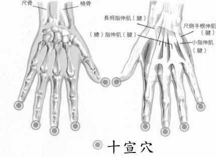 《中風急救●閱後傳知他人,功德無量●》