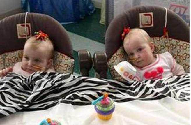 他們還在為有雙胞胎而狂喜 醫生做完超音波後卻變了臉色！