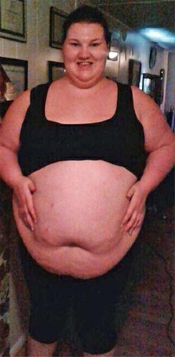 26歲年輕媽媽一個月減掉109公斤，結果卻沒實現變身天鵝的夢想……