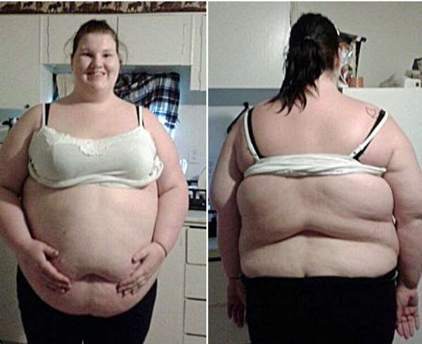 26歲年輕媽媽一個月減掉109公斤，結果卻沒實現變身天鵝的夢想……
